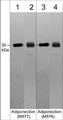 Western blot analysis of mouse white adipose tissue (lanes 1 & 3) and human recombinant full length adiponectin (lanes 2 & 4). The blot was probed with mouse monoclonals anti-Adiponectin (C-terminal) antibody M577 (lanes 1 & 2) or anti-Adiponectin (C-terminal) antibody M576 (lanes 3 & 4).