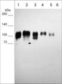 Western blot of human LNCaP prostate adenocarcinoma (lane 1), MCF-7 breast ductal carcinoma (lane 2), NCI-H28 pleural mesothelioma (lane 3), A431 epidermoid carcinoma (lane 4), MDAMB-231 breast carcinoma (lane 5) and Jurkat T-cell line (lane 6). The blot was probed with mouse monoclonal anti-B7-H3/CD276 (BM0451) at 1:500.