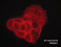 Immunocytochemical labeling of B7-H3 in aldehyde fixed human MCF-7 breast ductal carcinoma cells. The cells were labeled with mouse monoclonal anti-B7-H3/CD276 (BM0451). The antibody was detected using goat anti-mouse DyLight® 594.