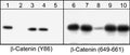 Western blot of β-Catenin immunoprecipitated from A431 cells treated with pervanadate. The blots were probed with β-Catenin (Tyr-86) or β-Catenin (a.a. 649-661) antibodies. The immunoprecipitates were untreated (lanes 1 & 6) or treated with alkaline phosphatase (lanes 5 & 10), and the antibodies were incubated with β-Catenin (Tyr-86) (lanes 2,7) or β-Catenin (a.a. 649-661) (lanes 3,8) peptides or phospho-Tyr (lanes 4,9).