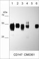 Western blot of lysates from BEAS normal lung cells (lane 1), NCIH28 mesothelial cells (lane 2), NCI-H1299 lung cancer cells (lane 3), LNCaP prostate cancer cells (lane 4), MCF7 breast cancer cells (lane 5), and A431 skin adenocarcinoma (lane 6). The blot was probed with mouse monoclonal anti-CD147 (CM0361) at 1:1000.