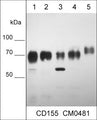 Western blot of human A549 lung carcinoma (lane 1), NCI-H446 small cell lung carcinoma (lane 2), NCI-H1299 lung carcinoma (lane 3), MDA-MB-231 breast carcinoma (lane 4), and A431 epidermoid carcinoma (lane 5). The blot was probed with mouse monoclonal anti-CD155 (CM0481) at 1:500.