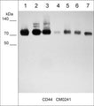 Immunocytochemical labeling of CD44 in paraformaldehyde fixed human MeWo cells. The cells were labeled with mouse monoclonal anti-CD44 (clone M024). The antibody was detected using goat anti-mouse DyLight® 594.