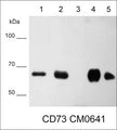 Western blot of native lysates including human CD73 recombinant protein (lane 1), NCI-H1915 lung carcinoma (lane 2), MeWo melanoma (lane 3), NCI-H1299 lung carcinoma (lane 4), and MDA-MB-231 breast carcinoma (lane 5). The blot was probed with mouse monoclonal anti-CD73 (CM0641) at 1:500.