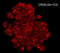 Immunocytochemical labeling of phosphorylated CREB in calyculin A-treated A431 cells. The cells were fixed in paraformaldehyde and permeabilized using NP-40 before labeling with mouse monoclonal CREB (Ser-133). The antibody was detected using goat anti-mouse DyLight® 594.