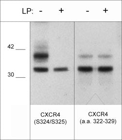 Western blot analysis of human Jurkat cells treated with 100 nM calyculin A for 30 min. then the blots were untreated (-) or treated (+) with lambda phosphatase. The blots were probed with rabbit polyclonals anti-CXCR4 (Ser-324/Ser-325) (left panel) or anti-CXCR4 (a.a. 322-329) (right panel).