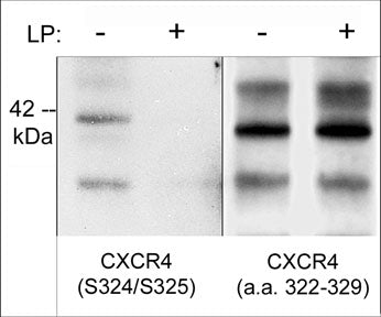 Western blot analysis of human Jurkat cells treated with 100 nM calyculin A for 30 min. then the blots were untreated (-) or treated (+) with lambda phosphatase. The blots were probed with rabbit polyclonal anti-CXCR4 (Ser-324/Ser-325) (left panel), or anti-CXCR4 (a.a. 328-338) (right panel).