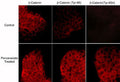 Immunocytochemical labeling of β-Catenin in control and pervanadate-treated A431 cells. The cells were labeled with mouse monoclonal β-Catenin (CM1181) or rabbit polyclonal β-Catenin (Tyr-86) or β-Catenin (Y654) antibodies, then the antibodies were detected using appropriate secondary antibodies conjugated to Cy3.