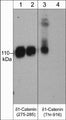 Western blot analysis of δ1-Catenin phosphorylation in A431 cells stimulated with calyculin A (100 nM) for 30 min. (lanes 1 & 3) then the blot was treated with lambda phosphatase (lanes 2 & 4). The blots were probed with either mouse monoclonal anti-δ1-Catenin (a.a. 275-285) (lanes 1 & 2) or rabbit polyclonal anti-δ1-Catenin (Thr-916) (lanes 3 & 4).