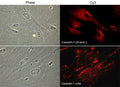 Immunocytochemical labeling of caveolin-1 in paraformaldehyde-fixed and NP-40-permeabilized rabbit spleen fibroblasts. The cells were labeled with rabbit polyclonal Caveolin-1 (N-terminal region) and mouse monoclonal Caveolin-1 antibodies, and detected using appropriate secondary antibodies conjugated to Cy3. Phase contrast images (left) and immunofluorescent images (right).