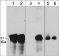 Western blot image of human A431 cells unstimulated (lanes 1, 3, & 5) or stimulated with pervanadate (1 mM) for 30 min (lanes 2, 4, & 6). The blots were probed with rabbit polyclonal caveolin-1 (N-term.) (lanes 1 & 2), mouse monoclonal caveolin-1 (Tyr-14) (lanes 3 & 4) or mouse monoclonal caveolin-1 (lanes 5 & 6).