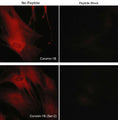 Immunocytochemical labeling of coronin-1B in rabbit spleen fibroblasts treated with Calyculin A. The cells were labeled with rabbit polyclonal Coronin-1B (C-terminus) and Coronin-1B (Ser-2) antibodies, then detected using appropriate secondary antibodies conjugated to Cy3. The antibodies were used in the absence (left) or presence (right) of their respective blocking peptide (CX2585 or CX2625).