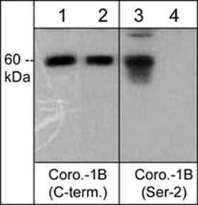 Western blot analysis of human A431 cells treated with Calyculin A (100 nM) for 30 min (lanes 1 & 3) before treatment with lambda phosphatase (lanes 2 & 4). The blots were probed with anti-Coronin-1B (C-terminal region) (lanes 1 & 2) and anti-Coronin-1B (Ser-2) (lanes 3 & 4).