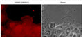 Immunocytochemical labeling of DAAM1 in aldehyde-fixed and NP-40-permeabilized A431 cells. The cells were labeled with mouse monoclonal DAAM1 (N-terminal region) antibody, then the antibody was detected using appropriate secondary antibody conjugated to DyLight® 594. The corresponding phase image is shown to the right.