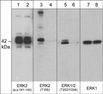 Western blot analysis of human A431 epithelial cells treated with 100 nM calyculin A for 30 min. (lanes 1, 3, 5, & 7) then the blot was treated with lambda phosphatase (lanes 2, 4, 6, & 8). The blots were probed with polyclonal anti-ERK2 (a.a. 181-195) (lanes 1 & 2), anti-ERK2 (Thr-188) (lanes 3 & 4), anti-ERK1/2 (Thr-202/Tyr-204) (lanes 5 & 6), or monoclonal anti-ERK1 (C-terminal region) (lanes 7 & 8).