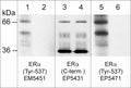 Western blot image of human MCF-7 cells treated with pervanadate (1 mM) for 30 min. (lanes 1-6). Some lanes of the blot were then treated with alkaline phosphatase (lanes 2, 4, & 6). The blot was probed with mouse monoclonal anti-ERα (Tyr-537) phospho-specific (lanes 1 & 2), rabbit polyclonal anti-ERα (C-terminus) (lanes 3 & 4), and rabbit polyclonal anti-ERα (Tyr-537) phospho-specific (lanes 5 & 6).