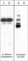 Western blot image of human A431 cells treated with pervanadate (1 mM) for 30 min (lanes 1 & 3) then treated with akaline phosphatase (lanes 2 & 4). Blots were probed with anti-E-Cadherin (Cytoplasmic) and anti-N-Cadherin (Tyr-860)/E-Cadherin (Tyr-835) conserved site.
