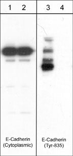 Western blot image of human A431 cells treated with pervanadate (1 mM) for 30 min (lanes 1 & 3) then treated with akaline phosphatase (lanes 2 & 4). Blots were probed with anti-E-Cadherin (Cytoplasmic) and anti-N-Cadherin (Tyr-860)/E-Cadherin (Tyr-835) conserved site.