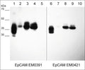 Western blot of native lysates including human EpCAM extracellular region (lane 1 & 6), MCF7 breast carcinoma (lane 2 & 7), A431 skin adenocarcinoma (lane 3 & 8), NCI-H1915 lung carcinoma (lane 4 & 9), and NCI-H446 lung carcinoma (lane 5 & 10). The blot was probed with mouse monoclonal anti-EpCAM (EM0391) (lanes 1-5) and mouse monoclonal anti-EpCAM (EM0421) (lanes 6-10) at 1:1000 each.