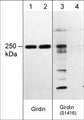Western blot image of human A431 cell lysates treated with Calyculin A (lanes 1-4). The blot was treated with lambda phosphatase to dephosphorylate Girdin phosphosites (lanes 2 & 4). The blot was probed with mouse monoclonal anti-Girdin (lanes 1 & 2) or rabbit polyclonal anti-Girdin (Ser-1416), phospho-specific (lanes 3 & 4).