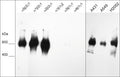 Native western blot image of human laminin isoforms: laminin 521 (α5β2γ1), laminin 121 (α1β2γ1), laminin 221 (α2β2γ1), laminin 332 (α3β3γ2), laminin 511 (α5β1γ1), laminin 411 (α4β1γ1), as well as human A431, A549, and NCI-H2052 cells. The blot was probed with mouse monoclonal anti-Laminin β2/γ1 subunit (LM0461) at 1:1000.