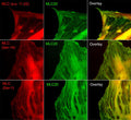 Immunocytochemical labeling of phosphorylated MLC in paraformaldehyde fixed A7r5 cells. The cells were dual-labeled with anti-MLC (MM3441; middle) and anti-MLC (MP4201; top left), anti-MLC (Ser-19) (MP4221; middle left) and anti-MLC (Ser-1) (MP3461; bottom left). Goat anti-Mouse DyLight® 488 and Goat anti-Rabbit DyLight® 594 were used for detection of primary antibodies. The overlay of staining patterns are shown to the right.