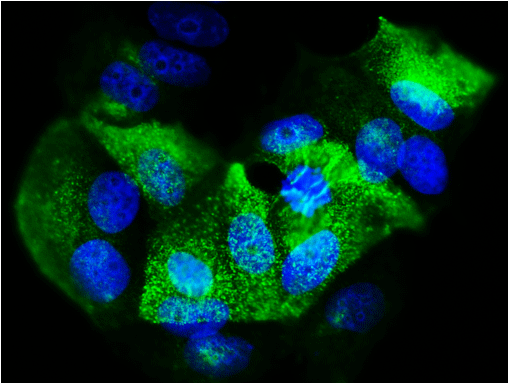 Anti-Epithelial Membrane Antigen (EMA) Antibody | MM-1001