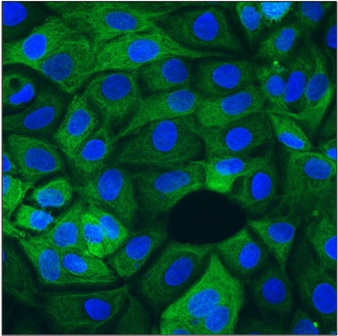 Immunofluorescent staining of MCF7 cells using 10 ug/mL mouse monoclonal anti-Cytokeratin-19 (CK19) antibody (MM-1002) (green). The cells were mounted with Antibodies Incorporated Fluoroshield with DAPI mounting medium (Cat. AR-6501). DAPI nuclear stain (blue) shows cell nuclei. Anti-CK19 stains the cytoskeleton of MCF7 cells.