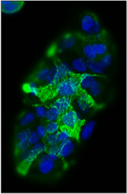 Immunofluorescent staining of SW1116 cells using 5 ug/mL mouse monoclonal anti-Sialyl Le (a) (19-9) antibody (MM-1003) (green). The cells were mounted with Antibodies Incorporated Fluoroshield with DAPI mounting medium (Cat. AR-6501). DAPI nuclear stain (blue) shows cell nuclei. Anti-Sialyl-Le stains the membrane of SW1116 cells.