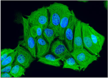 Immunofluorescent staining of MCF7 cells using 1 ug/mL Antibodies Incorporated mouse monoclonal anti-Cytokeratin-18 (CK18) antibody (MM-1009) (green). The cells were mounted with Antibodies Incorporated Fluoroshield with DAPI mounting medium (Cat. AR-6501). DAPI nuclear stain (blue) shows cell nuclei. Anti-CK18 stains the cytoskeleton of MCF7 cells.