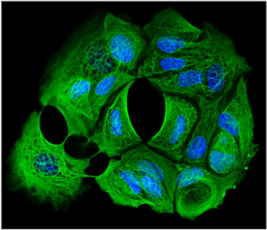 Immunofluorescent staining of MCF7 cells using 1 ug/mL mouse monoclonal anti-Cytokeratin-cocktail antibody (MM-1012) (green). The cells were mounted with Antibodies Incorporated Fluoroshield with DAPI mounting medium (Cat. AR-6501). DAPI nuclear stain (blue) shows cell nuclei. Anti-Cytokeratin-cocktail stains the cytoskeleton of MCF7 cells.