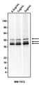 Western blotting of HepG2 cell lysate using 0.2 ug/mL, 1 ug/mL, or 5 ug/mL mouse anti-Cytokeratin cocktail antibody (MM-1012).