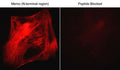 Immunocytochemical labeling of Memo in rabbit spleen fibroblasts that were fixed in paraformaldehyde and permeabilized with NP-40. The cells were probed with the Memo (N-terminal Region) MP3721, then the antibody was detected using goat anti-rabbit DyLight® 594. The antibody was used in the absence (left) or presence (right) of it's blocking peptide (MX3725).
