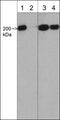 Western blot image of human A431 cells. The blots were untreated (lanes 1 & 3) or treated with lambda phosphatase (lanes 2 & 4), then probed with rabbit polyclonal Myosin IIA Heavy Chain (Ser-1943), phospho-specific antibody (lanes 1 & 2) or rabbit polyclonal Myosin IIA Heavy Chain (a.a. 1936-1950) antibody (lanes 3 & 4).