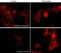 Immunocytochemical labeling of phosphorylated N-Cadherin in pervanadate-treated mouse C2C12. The cells were labeled with mouse monoclonal N-Cadherin (Cytoplasmic) and rabbit polyclonal N-Cadherin(Tyr-820) antibodies, then the antibodies were detected using appropriate secondary antibodies conjugated to Cy3.