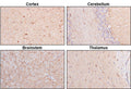 Representative sections of formalin fixed, paraffin-embedded rat brain showing staining of NDRG2. The sections were stained with Aves Labs anti-NDRG2 antibody at 1:1000 dilution and detected with anti-chicken HRP.