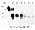 Western blot of NM0161 immunoprecipitates (IP) and whole lysates. The NM0161 antibody only (lane 1), IP from A431 cell lysate (lane 2), A431 cell input (lane 3), LNCaP cells (lane 4), MeWo cells (lane 5), and normal human lung (lane 6) and skin (lane 7). The blot was probed with anti-Na+/K+ ATPase β3 NM0161 (lanes 1-7). The arrow designates native antibody, while the β3 subunit migrates around 40 kDa.