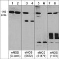 Western blot analysis of human umbilical vein endothelial cells treated with calyculin A (100 nM) for 30 min. (lanes 1, 3, 5, & 7) then the blots were treated with lambda phosphatase (lanes 2, 4, 6, & 8). The blots were probed with anti-endothelial nitric oxide synthase (eNOS) (C-terminal region) (lanes 1 & 2), anti-eNOS (Ser-632) (lanes 3 & 4), anti-eNOS (Ser-1177) (lanes 5 & 6), or anti-eNOS (a.a. 1172-1181) (lanes 7 & 8).