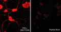 Immunocytochemical labeling of PKC phosphorylation in aldehyde-fixed and NP-40-permeabilized NGF-differentiated PC12 cells. The cells were labeled with rabbit polyclonal anti-PKCα (Ser-657/Tyr-658) (PP1091) antibody in the absence (Left) or presence (Right) of blocking peptide (PX1095). The antibody was detected using appropriate secondary antibody conjugated to DyLight® 594.