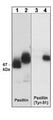 Western blot analysis of A431 cells (30 µg/lane) serum starved overnight (lane 1 & 3) or treated with pervanadate (1 mM) for 30 min (lanes 2 & 4). The blot was probed with anti-Paxillin (PM1071) or anti-phospho-Paxillin (Tyr-31) (PM1021).
