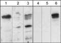 Western blots showing mouse brain (lanes 1 & 4), and Cos-7 cells untransfected (lanes 2 & 5) or transfected with mouse myc-tagged Plexin-A1 (lanes 3 & 6). The blots were probed with either affinity purified anti-Plexin-A1 (PP1471); lanes 1-3) or with mouse monoclonal anti-Myc (lanes 4-6).