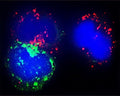 Confocal microscopy of cytospin-isolated human white blood cells, stained with rabbit anti-Beclin-1 antibody (R-141-100 at 1:200, red), reveals classic punctate pattern consistent with localization to autophagosomes. Co-staining performed with anti-Myeloperoxidase (MPO, green) and a Hoechst nuclear counterstain (blue), identifying both MPO-positive neutrophils and MPO-negative lymphocytes. Detection of Beclin-1 with varying signal intensity in these distinct cell types reflects their different real-time levels of autophagic activity.