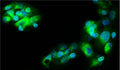 Immunofluorescent staining of HepG2 cells using 10 ug/mL rabbit polyclonal anti-Ferritin antibody (RP-4001) (green). The cells were mounted with Antibodies Incorporated Fluoroshield with DAPI mounting medium (Cat. AR-6501). DAPI nuclear stain (blue) shows cell nuclei. Anti-Ferritin stains the endogenous ferritin in the cytoplasm of HepG2 cells.