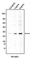 Western blotting of HepG2 cell lysate using 0.2 ug/mL, 1 ug/mL, or 5 ug/mL Antibodies Incorporated rabbit anti-Ferritin heavy chain antibody (RP-4001). RP-4011 rabbit anti-Ferritin antibody recognizes endogenous Ferritin heavy chain at ~25 kDa.