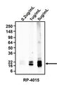 Western blotting of rat brain homogenates using 0.2 ug/mL, 1 ug/mL, or 5 ug/mL rabbit polyclonal anti-Myelin Basic Protein (MBP) (RP-4015). RP-4015 rabbit anti-MBP recognizes endogenous MBP at 20 kDa.