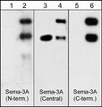 Western blots of neonatal rat brain (lanes 1, 3 & 5) and human recombinant Sema3A/Fc chimera (95/125 kDa) (lanes 2, 4 & 6). Blots were probed with anti-Sema3A (SP1401) (lanes 1 & 2), anti-Sema3A (SP1221) (lanes 3 & 4) and anti-Sema3A (SP1241) (lane 5 & 6). The antibodies recognize both the 95 kDa and 125 kDa forms of the recombinant Sema3A.