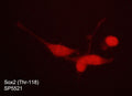 Immunocytochemical labeling of phosphorylated Sox2 in aldehyde fixed and NP-40 permeabilized human NCI-H446 lung carcinoma cells. The cells were labeled with rabbit polyclonal anti-Sox2 (Thr-118)
phospho-specific (SP5521). The antibody was detected using goat anti-rabbit DyLight® 594.