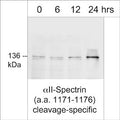 Western blot analysis of adult mouse diaphram treated with thapsigargin for 0, 6, 12, or 24 hours to induce cleavage of αII-spectrin from 250 kDa to 136 kDa. The blot was probed with rabbit polyclonal αII-spectrin (a.a. 1171-1176) cleavage-specific antibody at a dilution of 1:1,000 (Image provided by Dr. Leigh Ann Callahan, Department of Internal Medicine, University of Kentucky.)