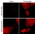 Immunocytochemical labeling of Stat5 in control and pervanadate-treated A431 cells. The cells were labeled with mouse monoclonal Stat5 (SM2511) or Stat5 (Tyr-694) (SM1481) antibodies, then the antibodies were detected using appropriate secondary antibody conjugated to DyLight® 594.