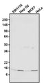 Western blotting of various cell lysates with chicken anti-TOMM20 antibody (0.2 µg/ml)(1:1000) and detected with anti-chicken HRP. Chicken anti-TOMM20 recognizes endogenous TOMM20 in all the cell lysates at ~16 kDa.